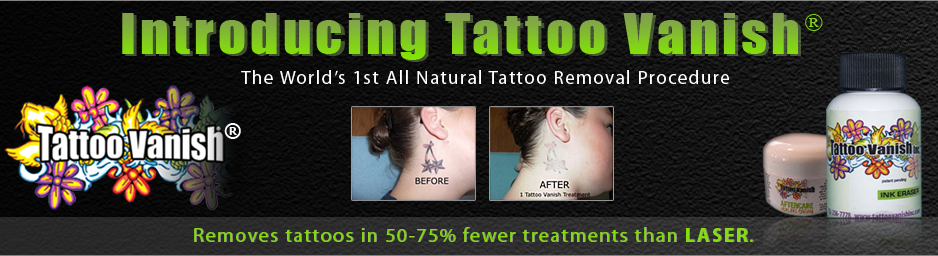 TATTOO REMOVAL - Bead World Beads